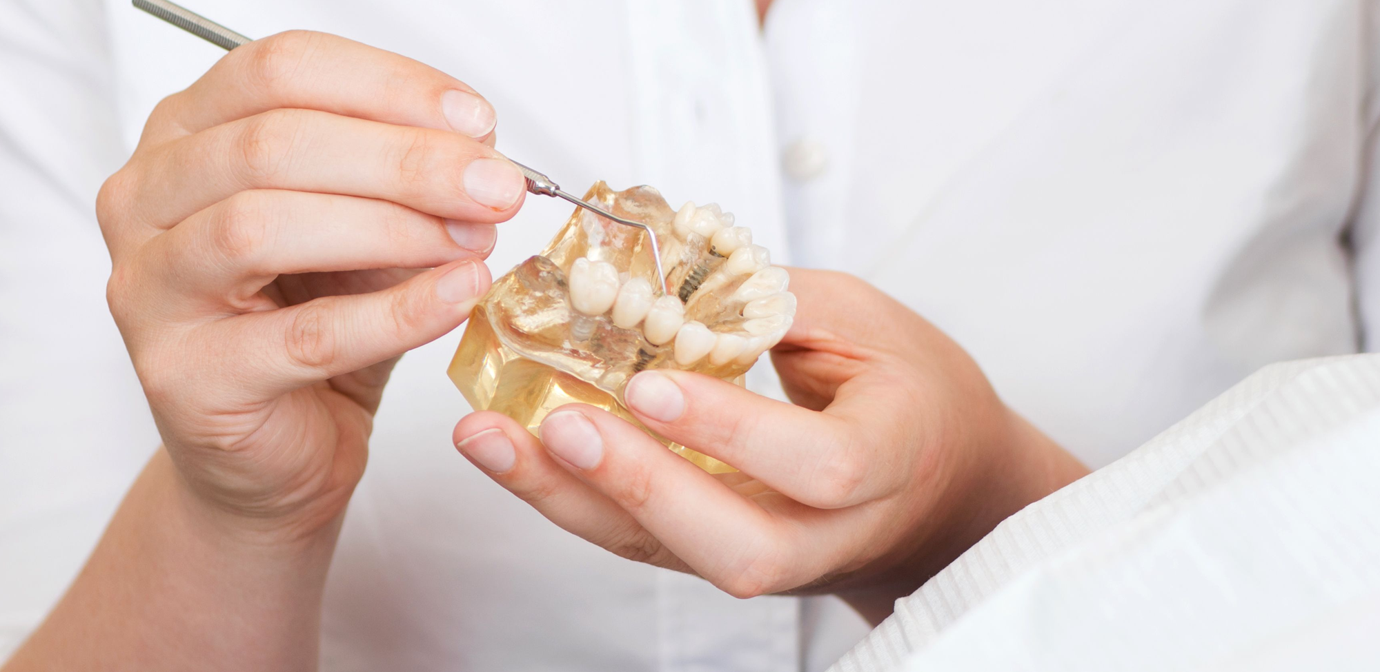 Preventing loose dental implants