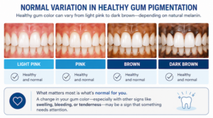 Examples of healthy gum pigmentation ranging from light pink to dark brown